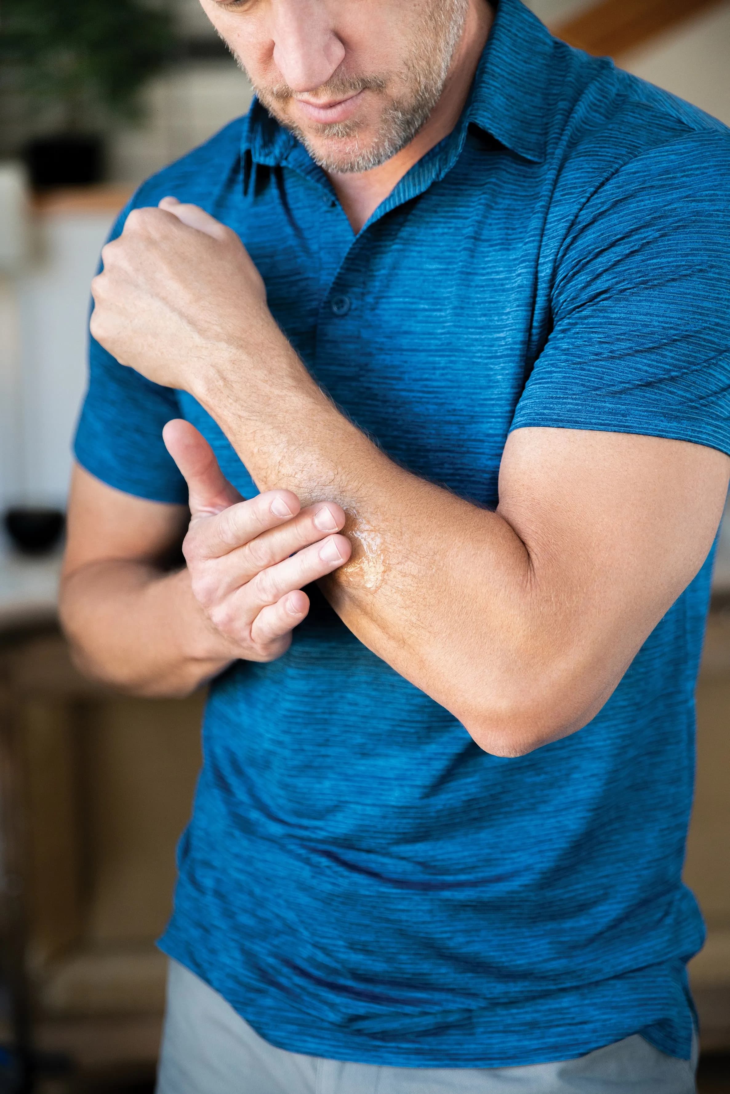 Renu28 Mann gelt Arm ein