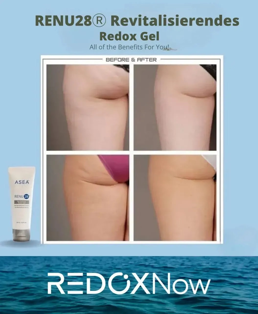 Ciao Ciao Cellulite – Sichtbar glattere Haut mit RENU28®